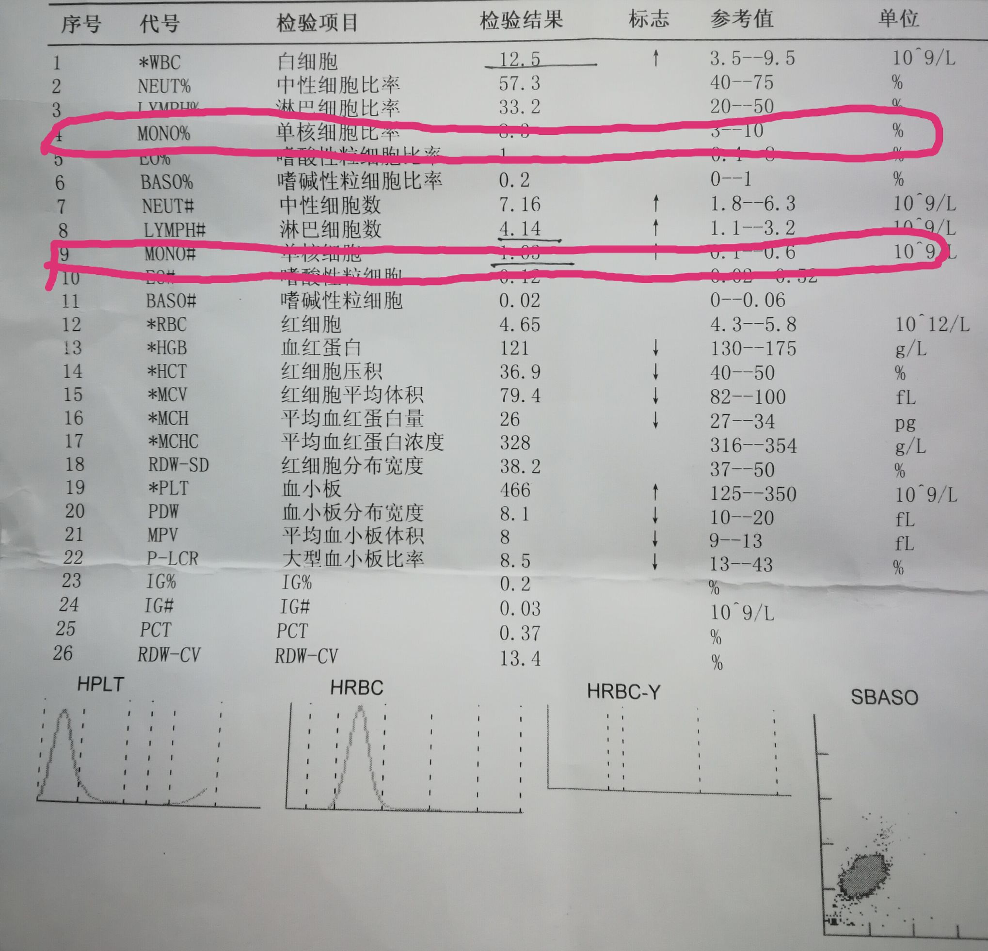 一分钟看懂化验单,化验单能看出肝功能不正常吗