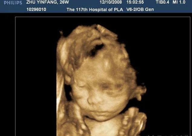 备孕2年检查遍了还怀不上咋办,备孕二年终于怀孕了