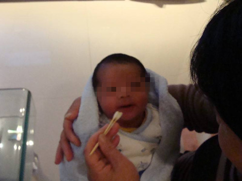 新生儿宝宝嘴巴长脓泡,宝宝嘴里上颚有脓包