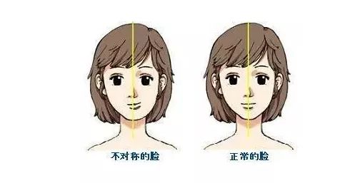 左右脸型不对称怎么矫正,怎么矫正自己的脸型