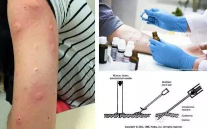 反反复复的过敏我该如何是好啊,又是一年春来到花粉过敏