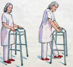 股骨头坏死想恢复血供怎么锻炼,股骨头坏死通过锻炼能恢复吗