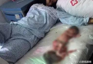 孕妇引产后胎儿奇迹存活,怀孕8个月引产胎儿怎么处理