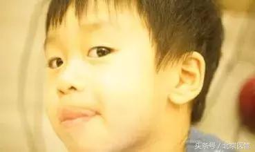 嘴唇干裂怎么快速恢复润唇膏,嘴唇干裂怎么润唇