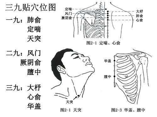 养生调理三九灸做起来,三九敷贴什么时候可以贴