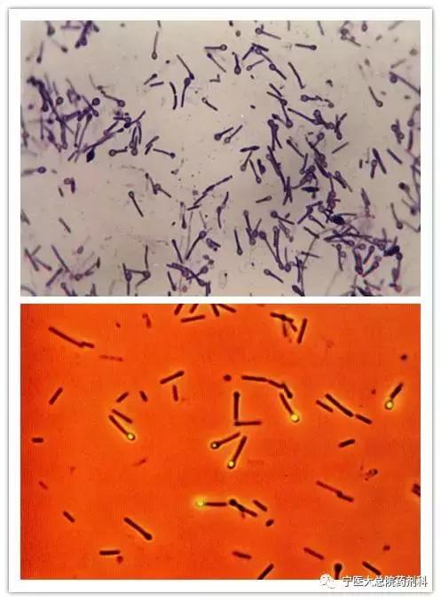 苦笑面容破伤风,破伤风苦笑面容可以治愈吗