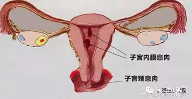 喝豆浆竟然会引起这个妇科病？