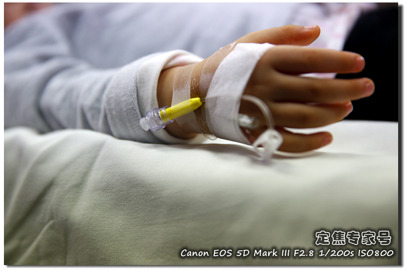 脸上大面积起红斑怎么回事,脸上红斑怎么消除最快