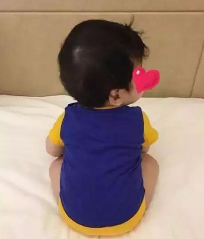 婴儿枕秃是缺钙吗很多家长都错了,宝宝有枕秃就一定是缺钙引起的么