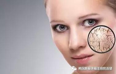 冬季皮肤干燥起皮泛红怎么办,冬季皮肤干裂脱皮怎么办