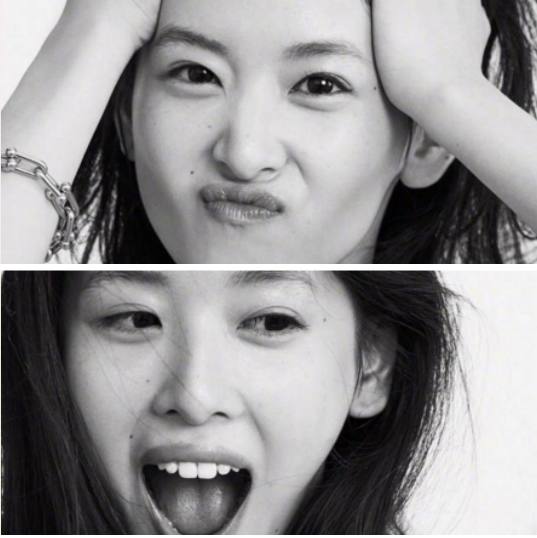 脸上黑痣去不掉，看奶茶妹是这样做的