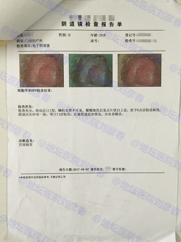 hpv18是尖锐性湿疣吗,hpv感染病例分享