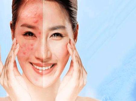 激素脸起红疹子怎么办,激素脸起红疹子特别痒起皮