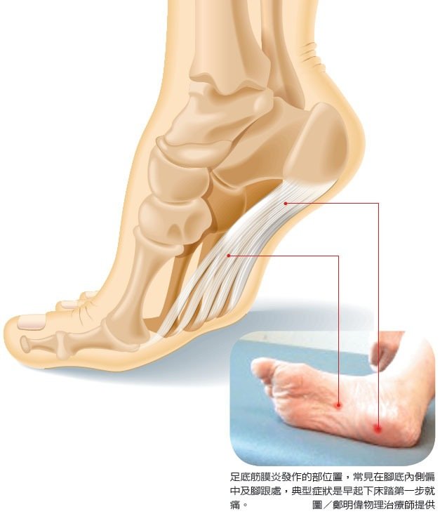 跑步有没有什么伤害,跑步如何减少身体的损伤