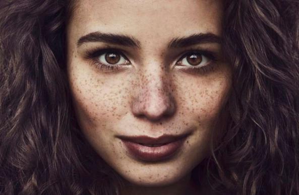 图解一分钟带你认清斑点分类，原来真的每个人都会长斑？