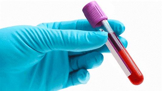 有甲状腺结节甲功五项tgab低,甲功五项能查出缺不缺碘吗