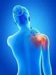 肩部疼科普,关于肩膀疼的科普视频