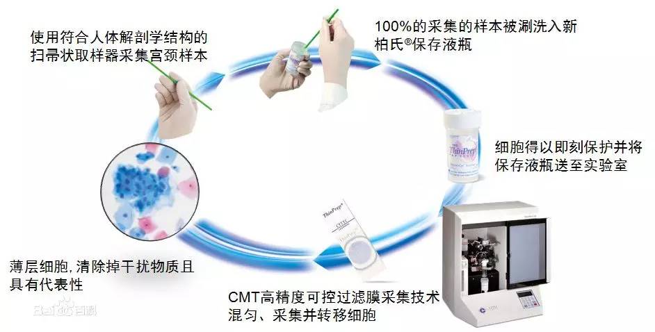子宫颈癌诊断与治疗指南,中国子宫颈癌防控指南