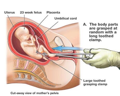 想要好孕怎么办,想要好孕都有什么技巧