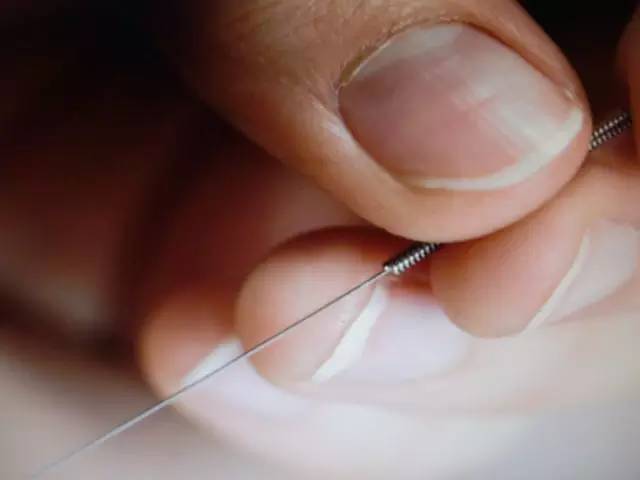 针灸怎么样治疗疾病的,针灸如何快速上手