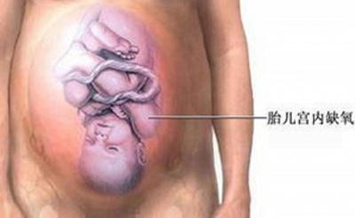 剖腹产麻醉针眼疼痛,剖腹产的时候打的麻醉痛不