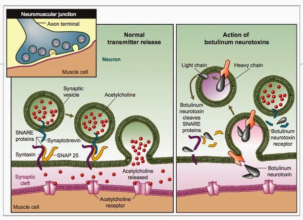 打了瘦腿针走路多影响效果吗,小腿第三次打瘦腿针还会有效果吗