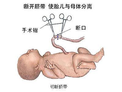 剖腹产麻醉针眼疼痛,剖腹产的时候打的麻醉痛不
