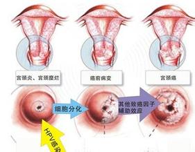 滚蛋吧肿瘤君插曲sunshinegirl,滚蛋吧肿瘤君歌曲