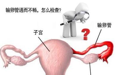 输卵管造影关注事项是什么,输卵管造影后饮食