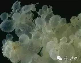 怀孕后竟然来了大姨妈？医生说：那不是好姨妈！