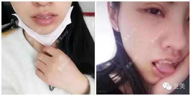 自从有了M唇，再也不愁撩男神~