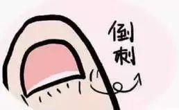 「涨姿势」随手一撕倒刺，她手指肿成萝卜！看完还敢手欠吗？