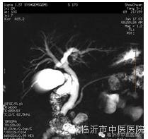 「高精设备」顶级MR7503.0T磁共振，疯狂打Call~