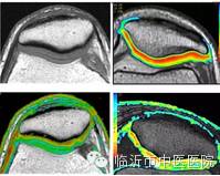 「高精设备」顶级MR7503.0T磁共振，疯狂打Call~