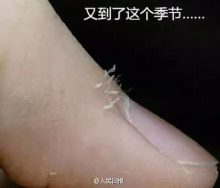 「涨姿势」随手一撕倒刺，她手指肿成萝卜！看完还敢手欠吗？
