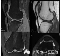 「高精设备」顶级MR7503.0T磁共振，疯狂打Call~