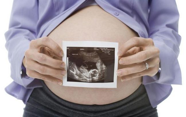 糖尿病人如何备孕二胎,二胎妈妈产检死亡