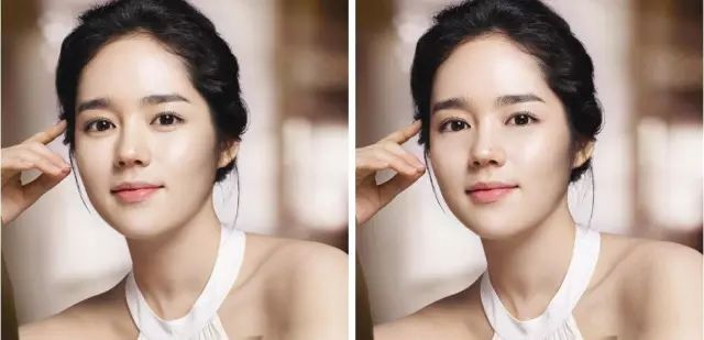 眼袋显老还是泪沟显老,40岁眼袋有泪沟怎么办