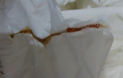 女孩意外怀孕却遭到男友的抛弃,女孩意外怀孕男友却不负责