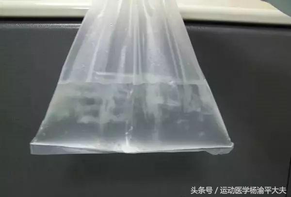 听说过什么是网球腿吗?