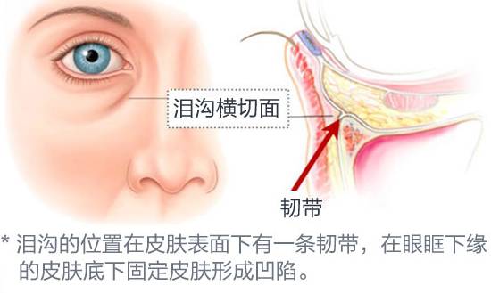 眼袋显老还是泪沟显老,40岁眼袋有泪沟怎么办