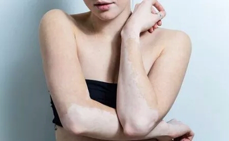 你的裤子穿几年了,内裤穿几年就该换了