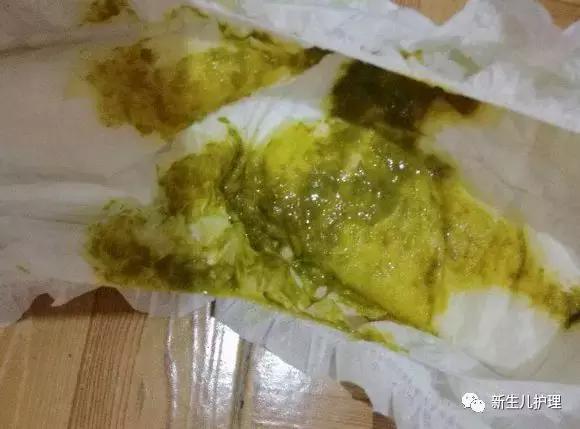 宝宝拉绿粑粑是怎么解决,宝宝拉绿粑粑什么原因怎么办