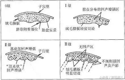 胎盘成熟度怎么看b超单,你对宫颈筛查了解多少