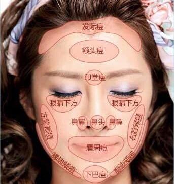脸部两侧长痘是什么原因怎么办,脸部不同部位长痘是什么原因