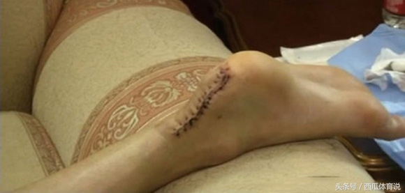 想要在体育界成功有多难，看了哈登的脚趾刘翔的跟腱你就懂