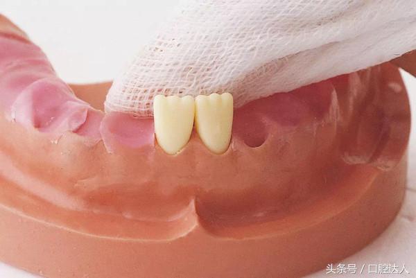 婴儿开始长乳牙该如何护理口腔,宝宝长恒牙怎么护理