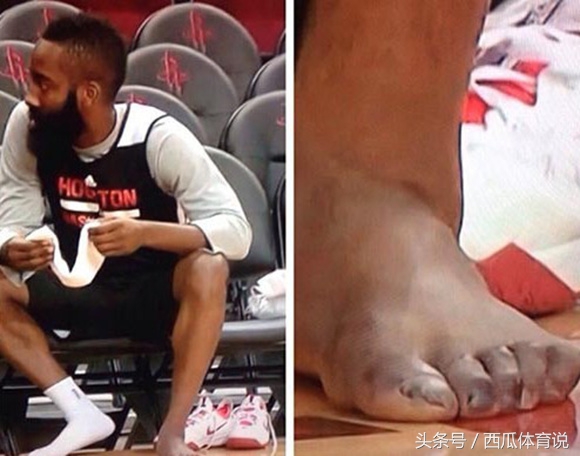 想要在体育界成功有多难，看了哈登的脚趾刘翔的跟腱你就懂