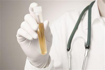 最快最有效的验孕方法,最靠谱的验孕方式