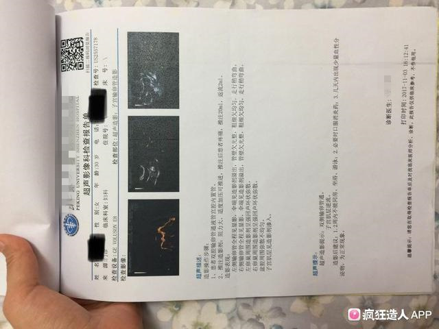 为了好孕，我连午休都在自“虐”